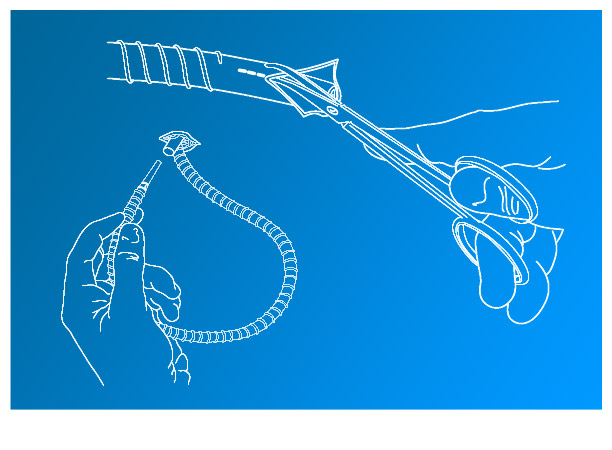 Illustration médicale pour Coloplast