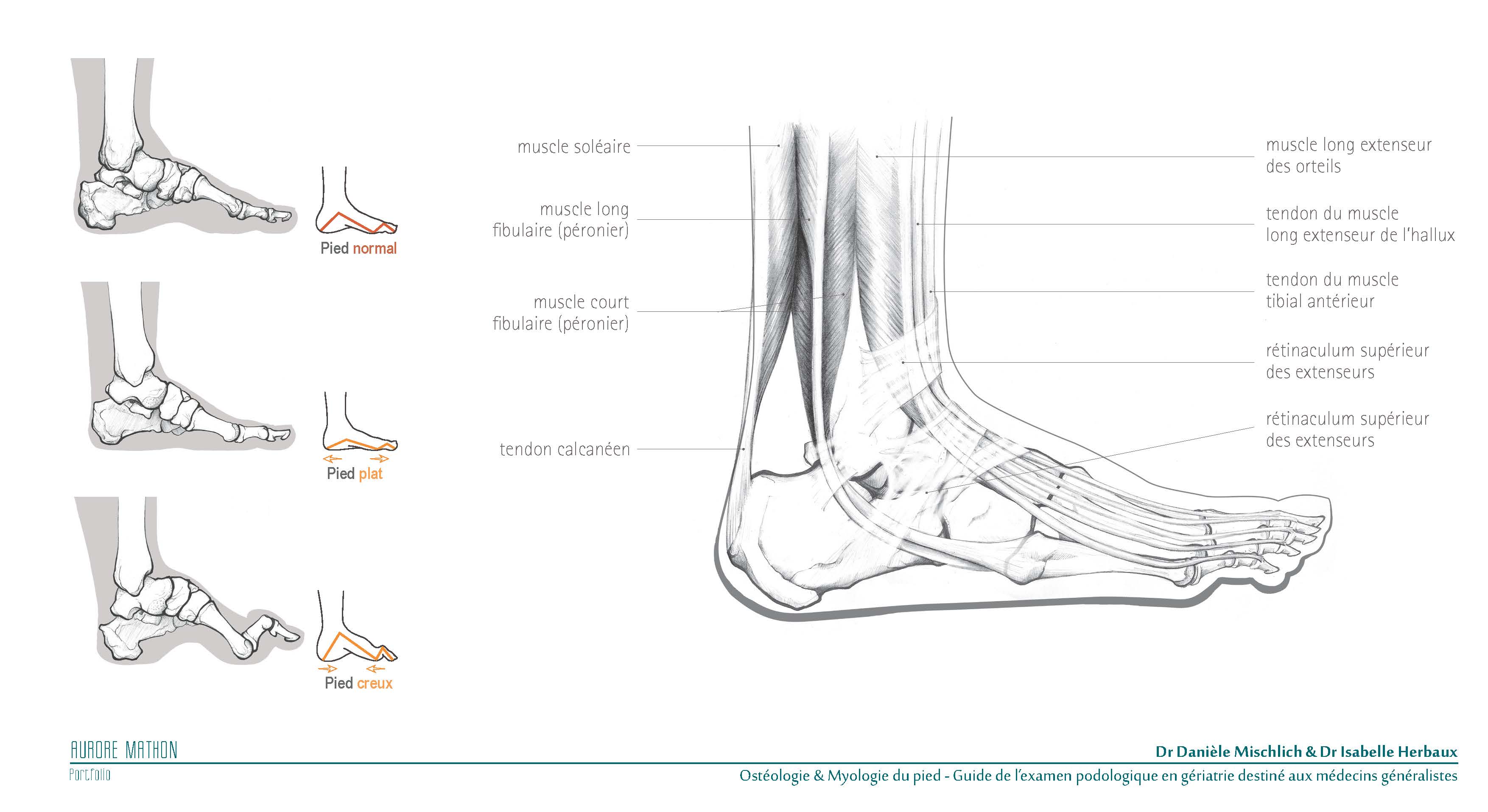 Ostologie et Myologie du pied