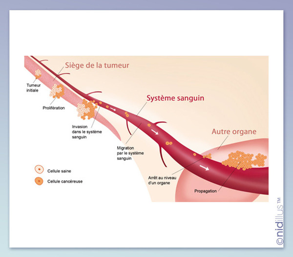 Illustration médicale
